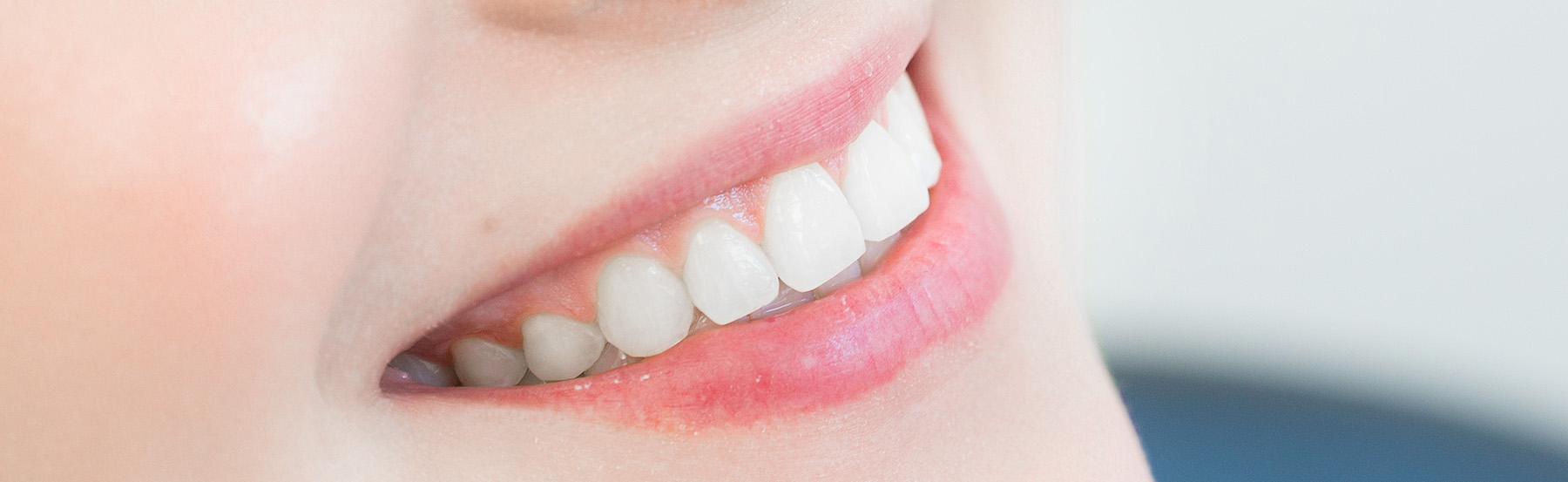 Weißes Lächeln in der Zahnarztpraxis Dr. Frodl